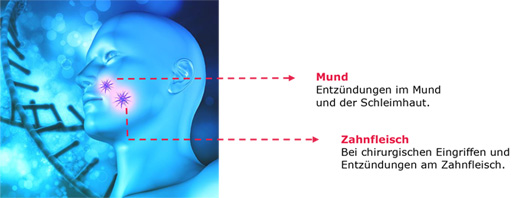 Hexoral® Behandlung